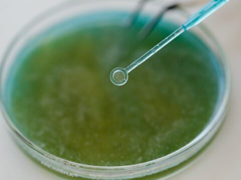 Cara Mengatasi Biduran Agar Tidak Kambuh Lagi Dengan Garam