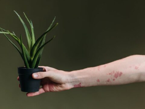 Manfaat Lidah Buaya Untuk Wajah Berjerawat Dan Berminyak